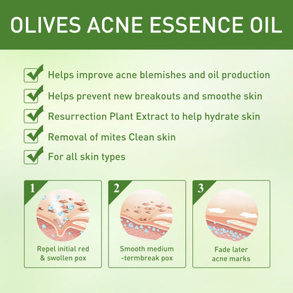Acne Clarifying Oil – Gentle Repair & Moisturizing (30ml)”